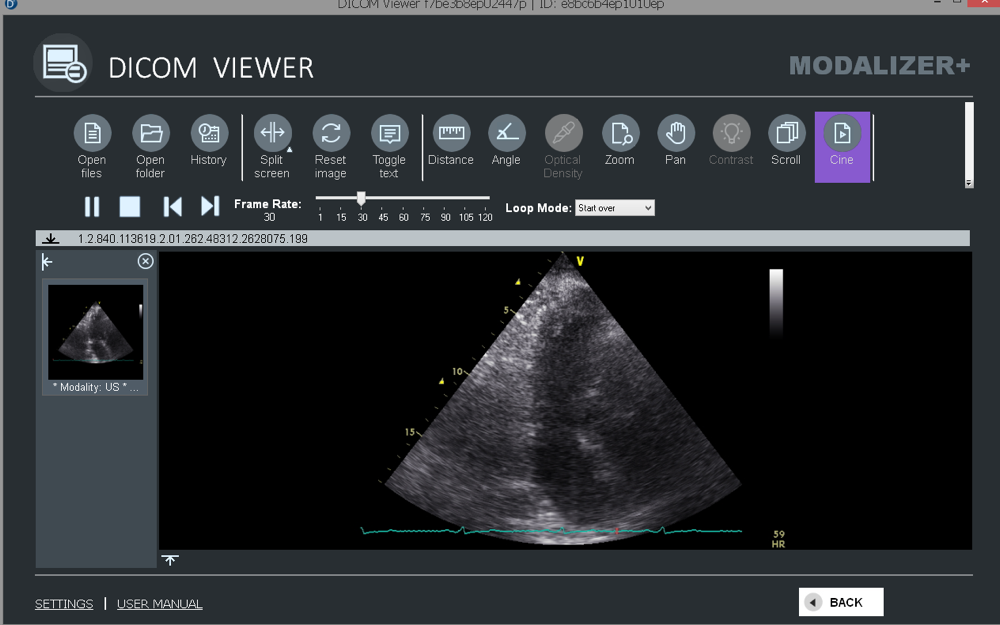 MODALIZER+ CINE tool controls for multi-frame DICOM cine loop playback