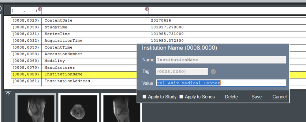 MODALIZER+ DICOM Editor data element edit form with Apply to Study and Apply to Series options