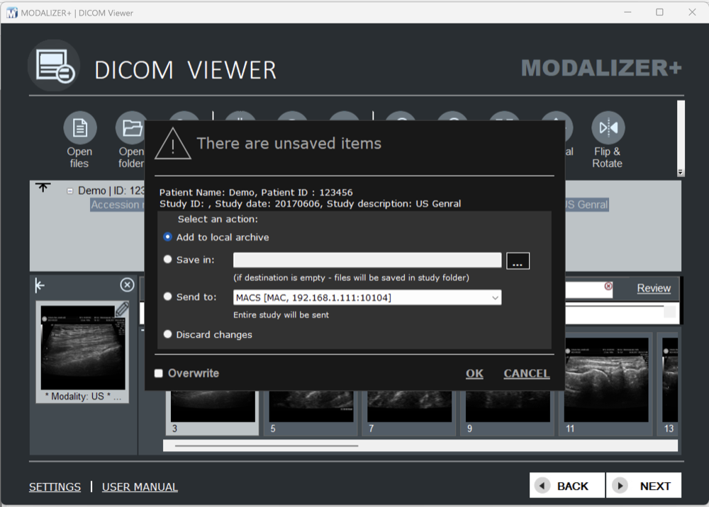 MODALIZER+ "There are unsaved items" dialog with Add to local archive, Save in, Send to, and Discard changes options, plus an Overwrite checkbox