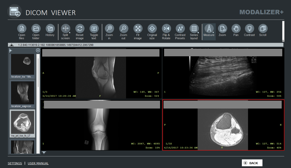 MODALIZER+ DICOM Viewer displaying four studies side by side in split-screen mode