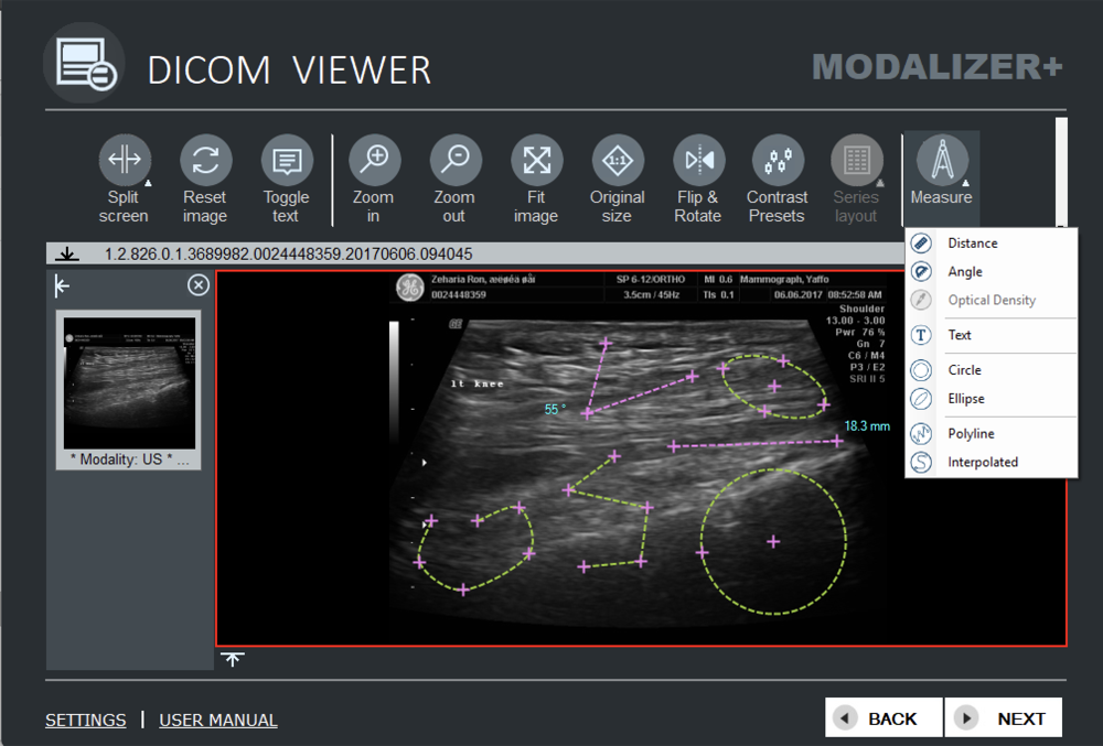 MODALIZER+ DICOM Viewer measurement tools: distance, angle, optical density and region annotations